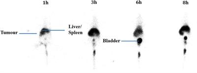 Biodistribution Study of Niosomes in Tumor-Implanted BALB/C Mice Using Scintigraphic Imaging